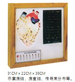 心臟傳導(dǎo)系電動(dòng)模型